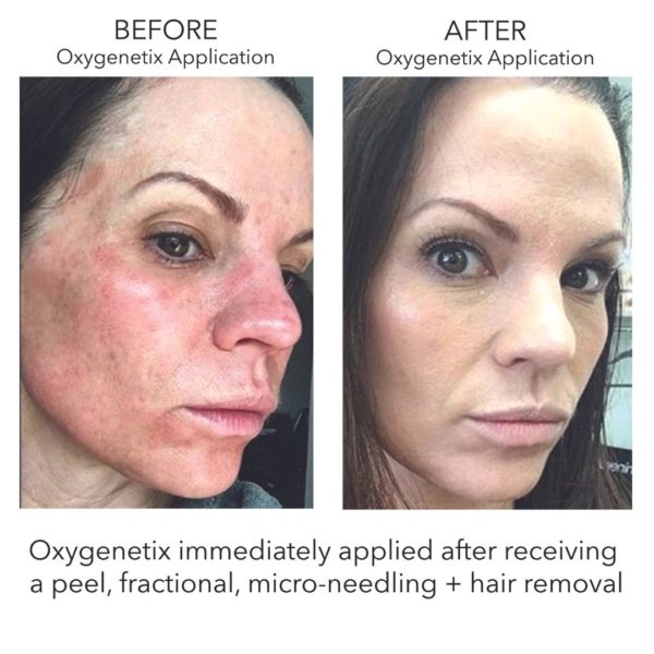 Oxygenetix Foundation - Image 3