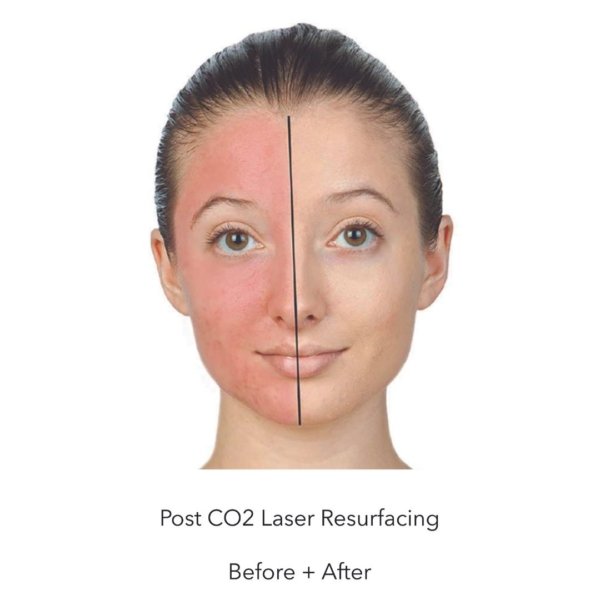 Oxygenetix Foundation - Image 4